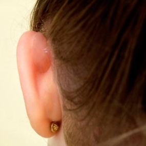 Opinión: Otostick para corregir las orejas de soplillo en bebés 